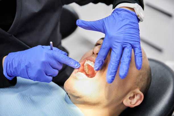 Best Emergency Root Canal Treatment in Harrison, NY